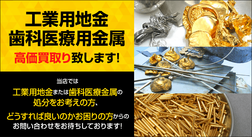 工業用地金・歯科医療金属 高価買取致します。